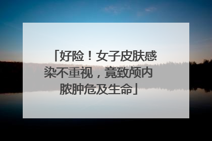 好险！女子皮肤感染不重视，竟致颅内脓肿危及生命